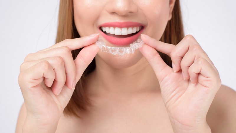 The Complete Guide to Invisalign Ireland and How It’s Disrupting Orthodontics